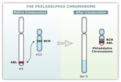 leucemia-mieloide-cronica